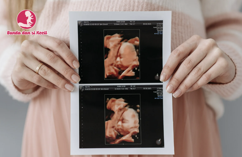 Tanda Janin Sehat di Trimester Kedua yang Harus Bunda Ketahui